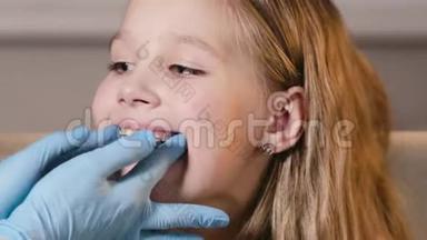 正牙医生在女孩的牙齿上放置一个特殊的盘子来对齐它们，在童年时矫正牙齿